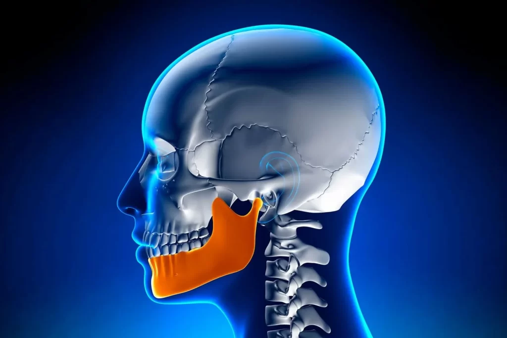 Rebuilding And Strengthening The Jawbone Img