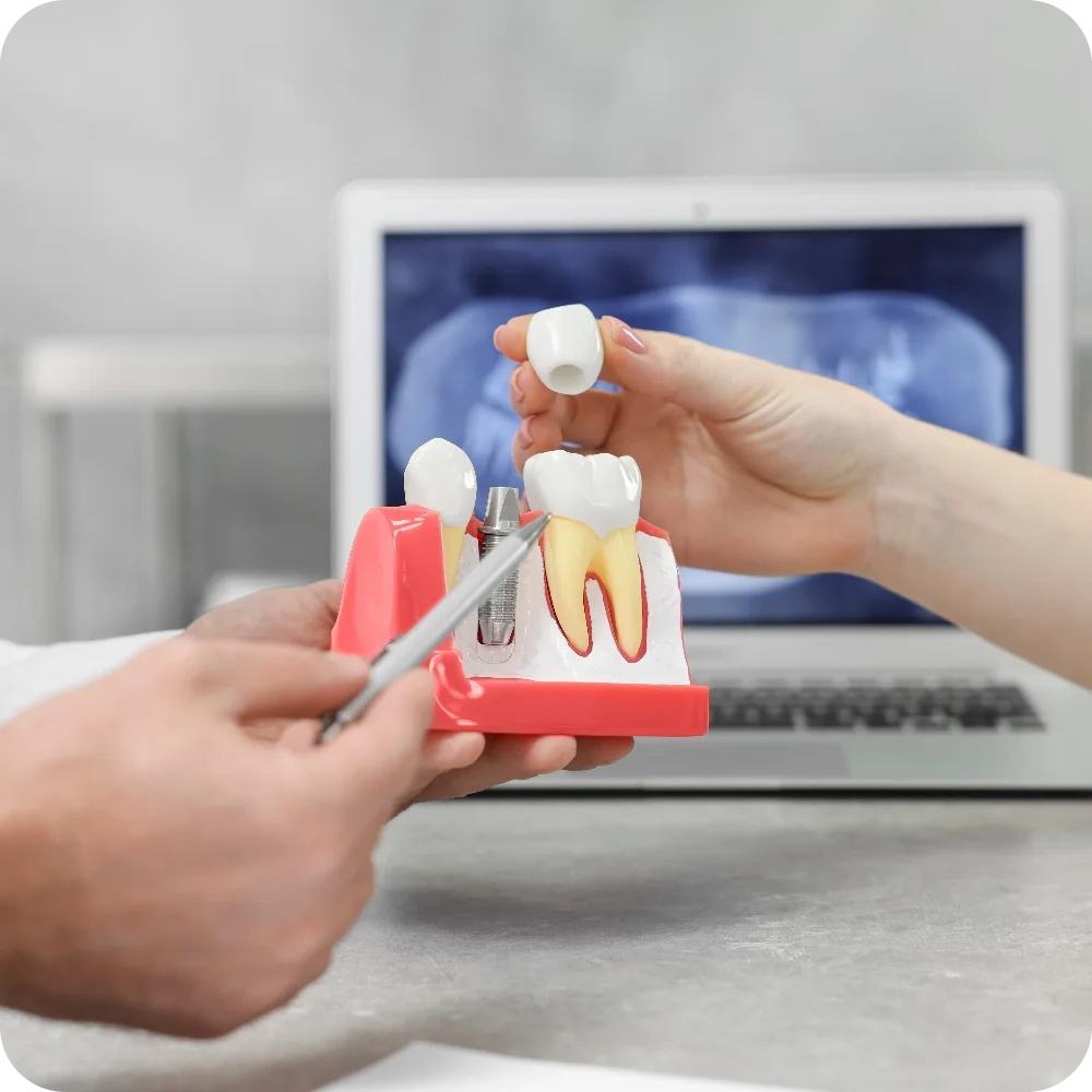Dental Implants Precision Img